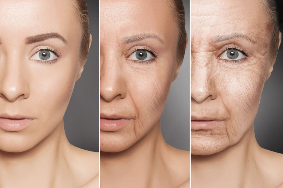 Facelift and Necklift