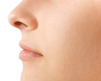 Rhinoplasty (Nose Surgery)